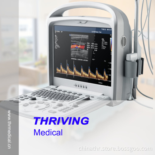 Portable Color Doppler Ultrasound Scanner